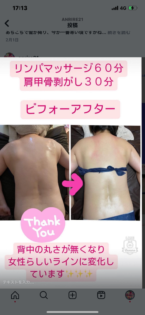 リンパマッサージ　肩甲骨剥がし　ビフォーアフター